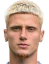 Louis Oppie